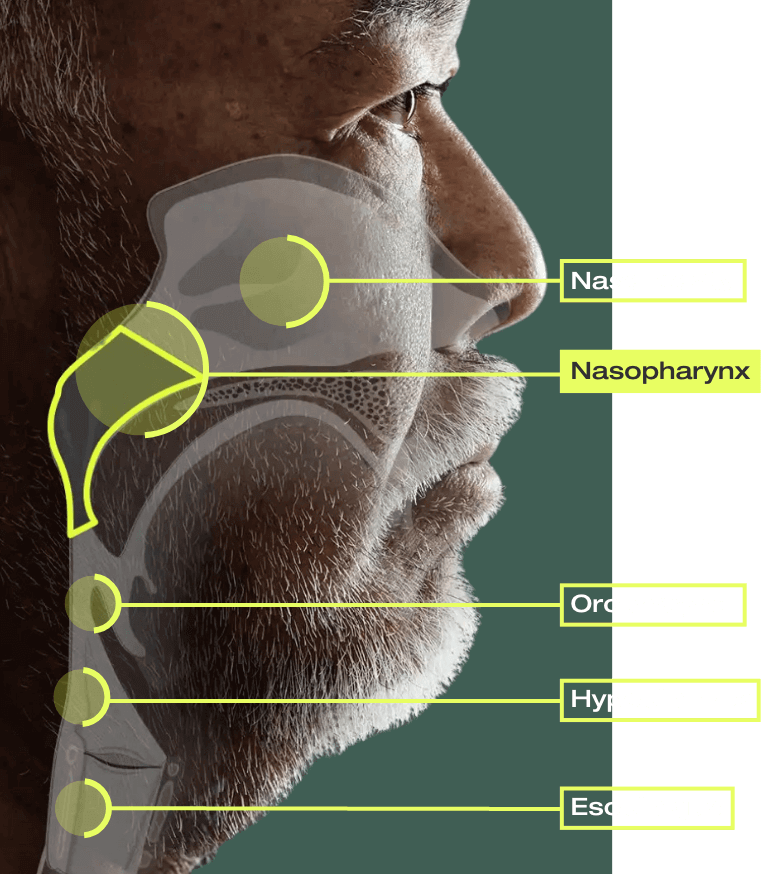 Infographic describes the nasopharyngeal cancer tumor location